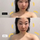 체리뷰티샵 | 신림 피부관리 추천 플라워뷰티샵 윤곽관리 드레스라인관리 후기