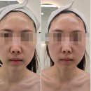 세븐일레븐 평택새시장점 | 오산피부관리 아네스뷰티 3V윤곽관리 테프팅 후기