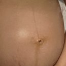 리제맘 임산부 일기 1탄 04~05월?