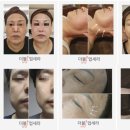 스파비알 네이버블로그