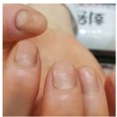 손톱 반달 조심해야 하는 크기(부평 코코네일)