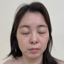 생리후 트러블 올라올 때 다녀온 피부관리 군산 감동스킨앤네일 산소근막테라피 후기
