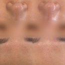 오신데렐라네일 | 웨딩관리ㅣ옥련동 피부관리 모공 스케일링 잘하는 곳 <롬앤스킨&네일>