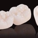 다이아몬드치과기공소 이미지