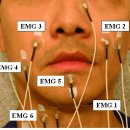 이동국신경과 | 안면마비 검사 (ENoG, EMG)