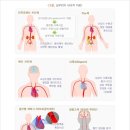 [통합간편]5대 심장질환 진단비 특별약관[만성 류마티스심 장질환, 심장염증질환, 심근병증, 부정맥, 심부전] 이미지