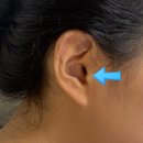 온산행복이비인후과의원 | [수영] 귀 통증, 첫 외이도염에 걸리다! 초기증상? (울산 온산읍 덕신 온산행복이비인후과)