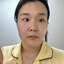 울트라짐 | 울트라 클리어 가격, 울트라 클리어 흉터 솔직 후기