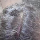 엘엔케이주식회사 | 로마샴푸 약 2개월쓰고난후