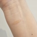 미보약국 | 에어프라이기 화상 후기💦 미보연고로 응급처치했어요!