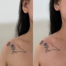 가꾸다 - 군포시 | 잠실역 피부관리 웨딩케어 위한 일자어깨 만들기 가꾸다 후기
