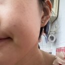 삼성밴스의원 네이버블로그