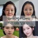 엄마와 딸이 같은 원장에게 이마거상 후기