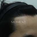모먼트의원 이미지