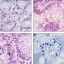 재첩(Corbicula fluminea)의 소화선 감염 미포자충 Morrittospora corbiculae 이미지