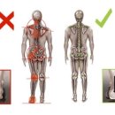 snpe체형교정 이미지