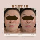 미인 | 물광피부 되찾기! 대구 달서구 피부관리 리얼후기