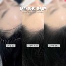 O:Na(오나) | 일산두피문신 일산 장항동 라페스타 오나뷰티 두피문신 탈모관리까지 한번에 시술했어용