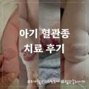 신영피부과의원 | 신생아 혈관종 - 8개월동안의 치료 후기