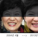 필러 이미지