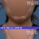 볼독