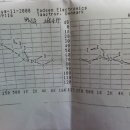 제 청력에 보청기 추천좀해주세요 이미지