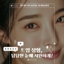 시원성형외과의원 이미지