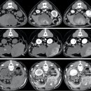 간과 비장 mass가 있는 개 52마리에서 dual-phase CT상의 특징과 조직검사 비교 이미지