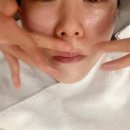 유앤아이(YOU&I)의원 서초점 | YOU&amp;I 평택점에서 LDM 물방울 리프팅 관리받은 여자의 촉촉한 후기^^