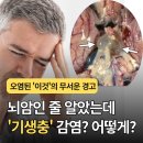 "뇌암인 줄 알았는데 '기생충' 감염?" 오염된 '이것'의 무서운 경고