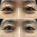 일산 [예쁘다,나] 무쌍 속눈썹펌 잘하는 곳 내돈내산후기 공개중 !!