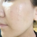 담화 - 중랑구 망우로48길 15 | 유담화 프로바이오틱스 크림 사용 후기