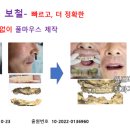 월드치과기공소 이미지