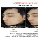 양주예쓰병원 | 경기양주피부과 어디가 잘할까? 잘하는 곳 선택 기준 3가지