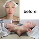 필 | 상무지구 비비에스테틱 트로이필 후기 쌍촌동 피부결 리셋 관리