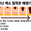 연세익약국 네이버블로그