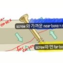 이글스크럽 이미지