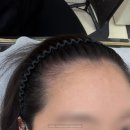 소원장 | 피씨엘코리아 - 두피SMP 잘하는 곳, 강남 헤어라인, 강남구청역 헤어라인, 강남 두피SMP 솔직후기