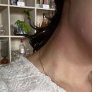 글로벌튼튼병원 | [대전 알레르기 검사 후기] 글로벌튼튼병원- mast 알레르기검사 💊