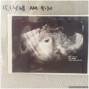 오체한의원 | [10개월이 아닌 9개월 만에 출산?!] 리얼 임신 과정과 출산 후기:::