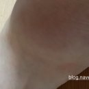 노운섭한의원 네이버블로그