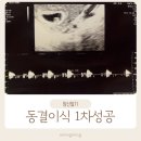 대자인병원 | 전주 시험관 동결이식 1차 대자인병원 난임센터 임신성공후기