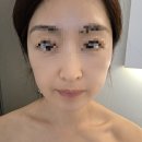 웰레스테틱 | 다산 피부관리 추천｜웰레스테틱 다산점 물광촉촉리프팅 후기, 속건조 고민 해결