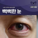 ABC안과의원 이미지
