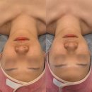 부산 진구 뷰티샵 에스테틱 추천 에르모아 l 작은얼굴관리 후기 예비신부관리