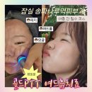 잠실 송파나루역피부과 골드PTT 여드름치료 후기｜2년 만에 다시 받은 이유