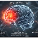 게임 중독이 뇌 발달에 미치는 영향 이미지