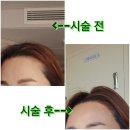 주은헤어라인