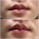 듀드롭 | 반짝이는 입술을 위한 YNM 듀드롭 립오일 01베이비핑크 후기