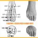 급체시 응급 처치 따주기 방법 이미지